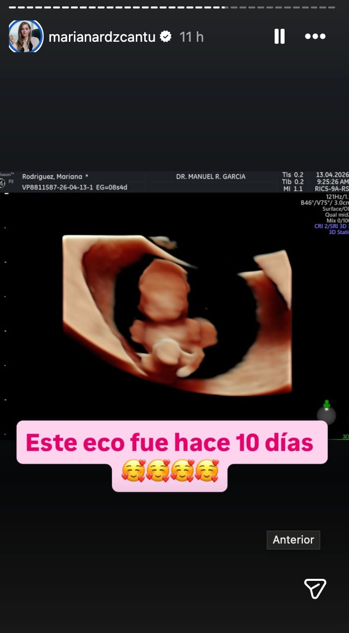 Mariana Rodríguez creó la imagen de ecografía de su embarazo con ChatGPT