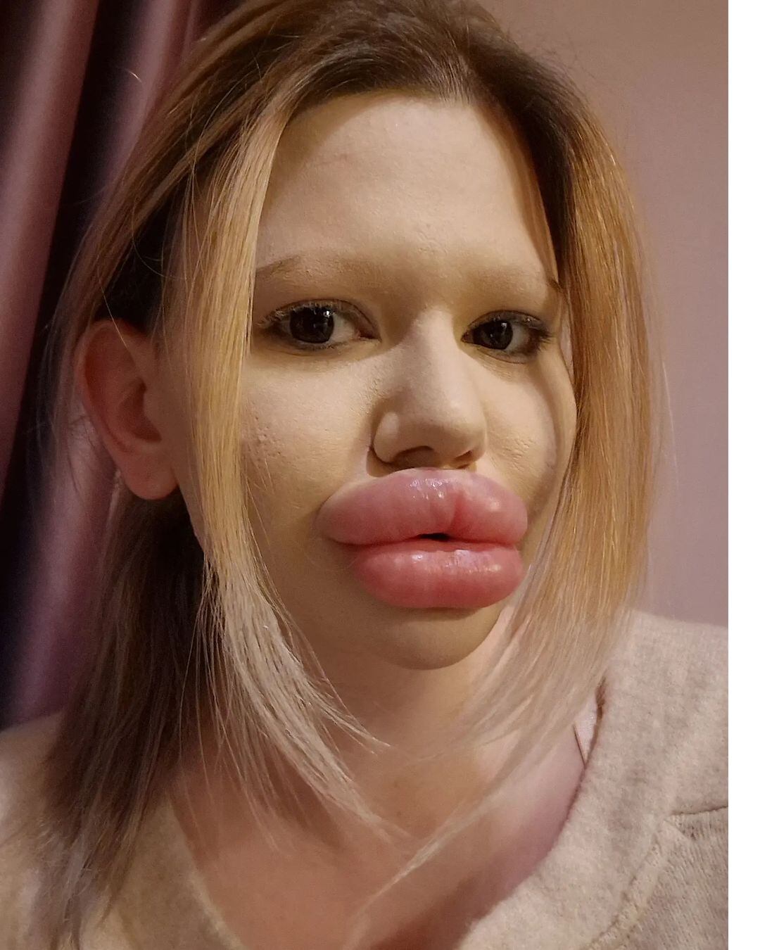 Andrea Ivanova, la mujer con los labios más grandes