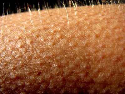 "Piel chinita"