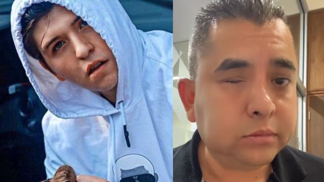 Escolta acusa a Fofo Márquez de golpearlo y provocar que perdiera un ojo