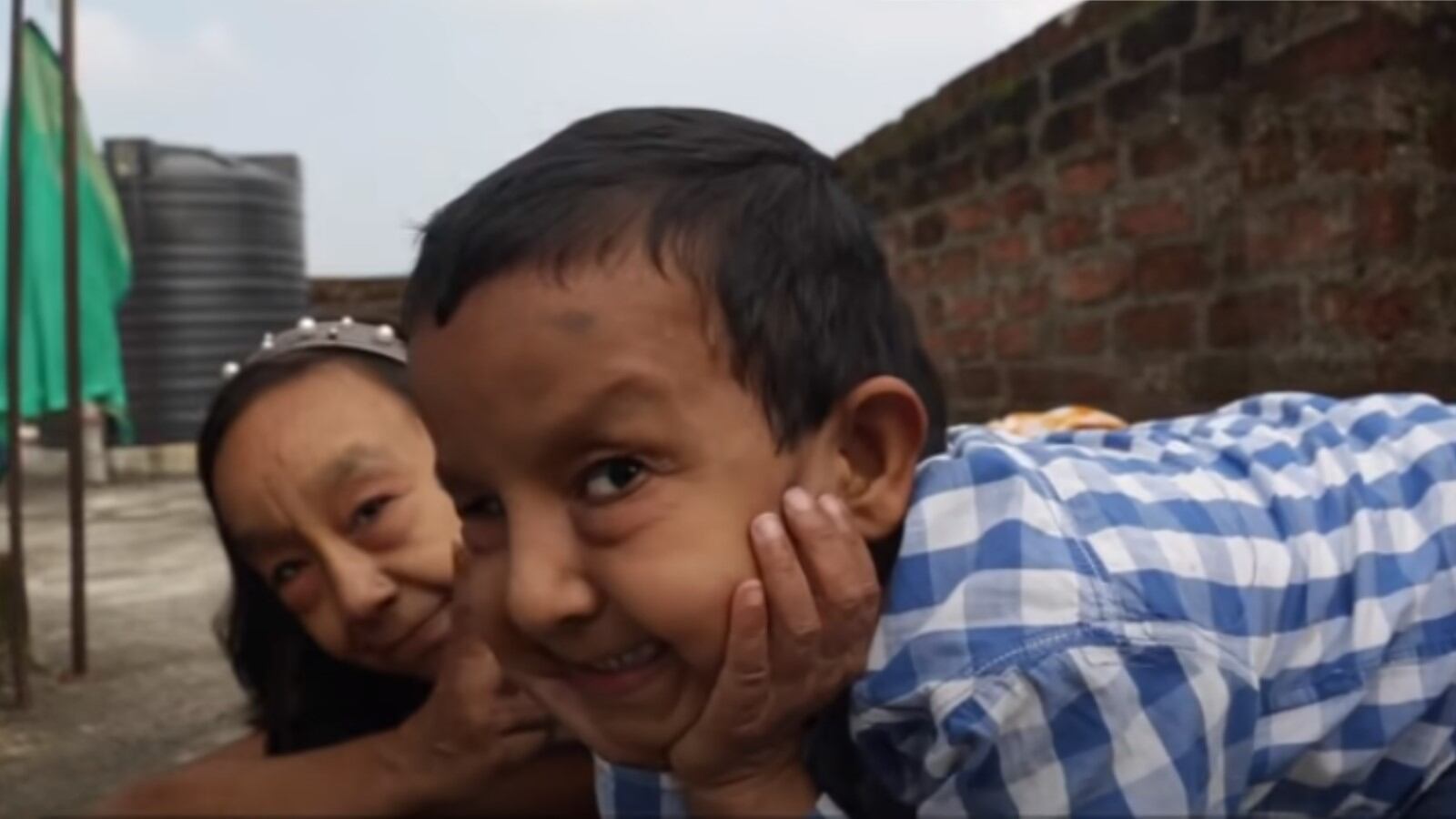 Hermanos con Progeria