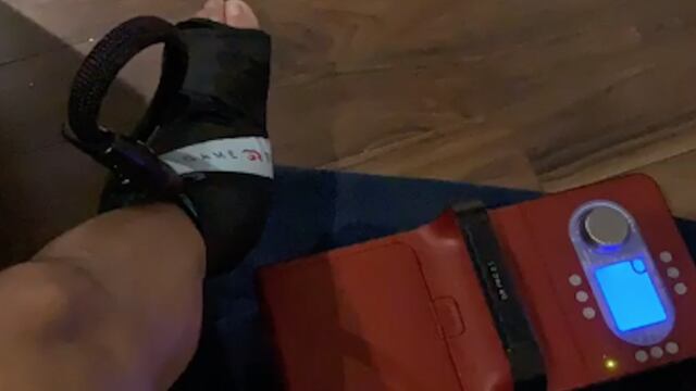 Corona compartió una historia con un aparato en uno de sus tobillos para su recuperación.