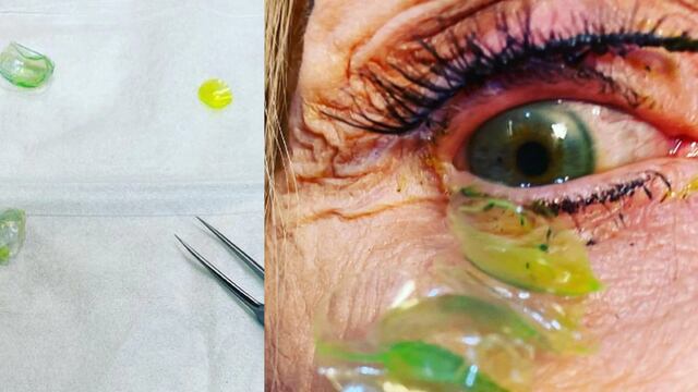 No se quitaba los lentes de contacto