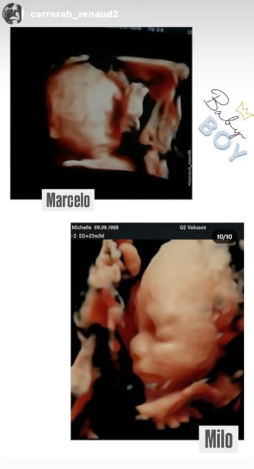 Michelle Renaud, nombre de su segundo bebé