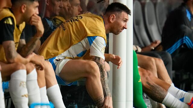 La impresionante imagen del tobillo de Lionel Messi que le dará la vuelta al mundo.