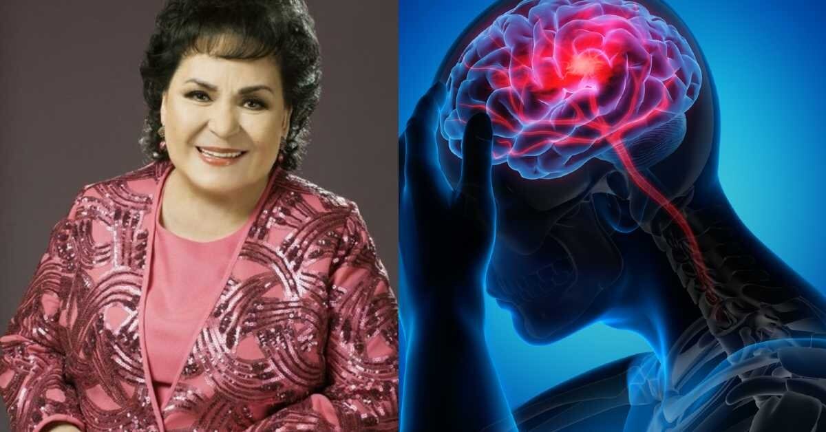 Neuróloga explica porque hemorragia y derrame cerebral es lo mismo