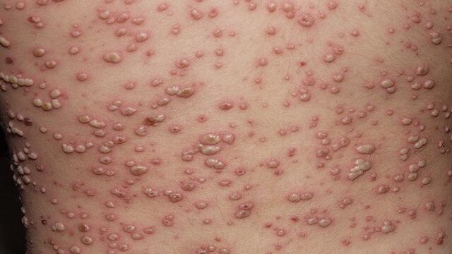 Foto: Tomada de Internet