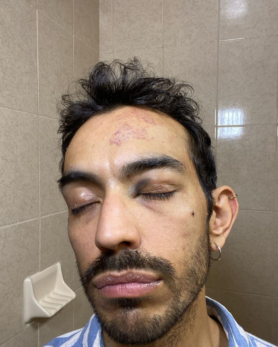 Stefano Coppola denuncia discriminación y agresiones en un Oxxo de la CDMX.