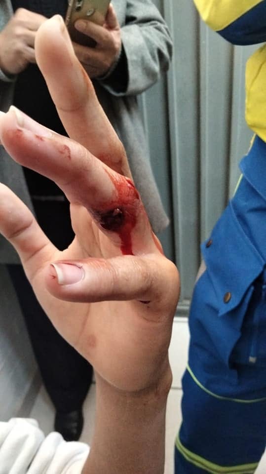 Lesión por pistola en la Escuela Secundaria Diurna N° 79 "República de Chile" de la CDMX