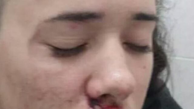 Golpean lesbiana brasil