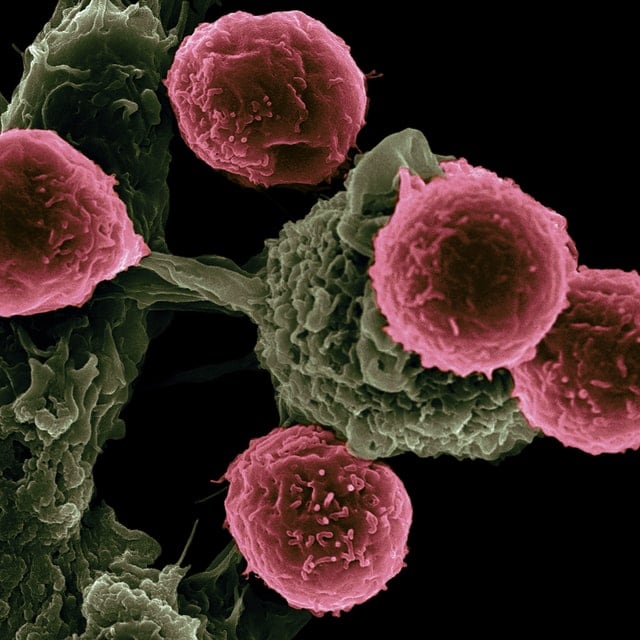 Cáncer