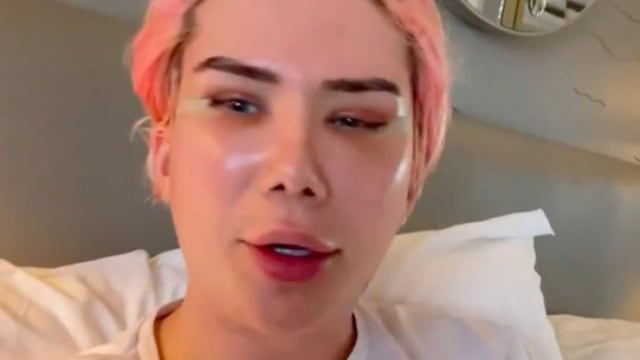 Youtuber se declara ‘coreano’ tras someterse a 18 cirugías