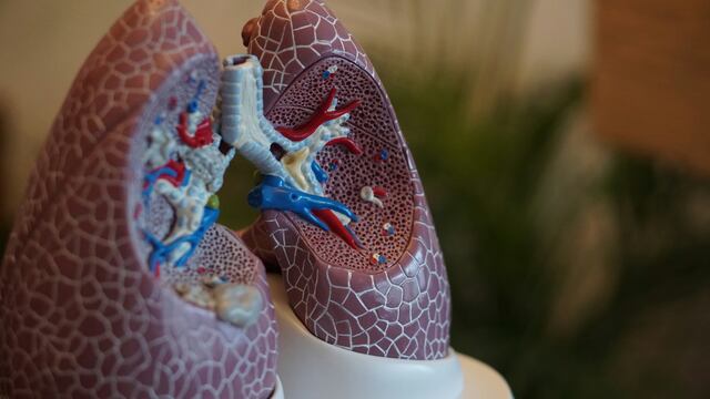 ¿Qué es la trombosis pulmonar?