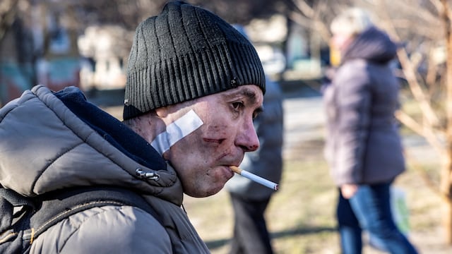 Ucraniano herido tras ataques militares de Rusia