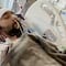 Covid-19 se ‘comió sus pulmones’; requirió doble trasplante pulmonar