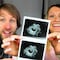 Jesse Ridgway confirma aborto por Trisomía 21 y pide un diálogo más humano