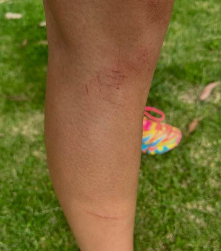Catherine Mayran Oliver, pentatleta, fue agredida en Bosque del Ocotal