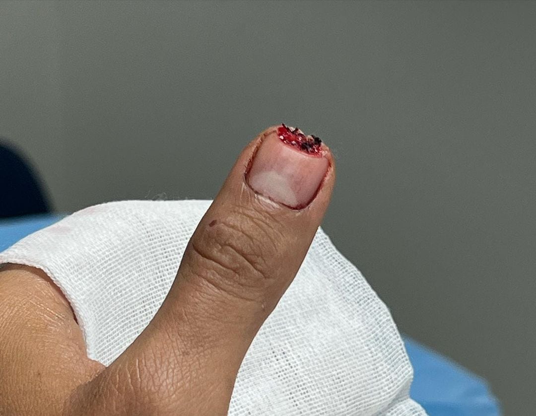 Ricardo Peralta se cortó el dedo en MasterChef Celebrity