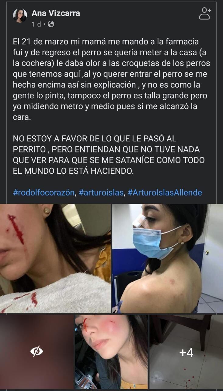 Adriana compartió fotos de las heridas que supuestamente provocó Rodolfo Corazón