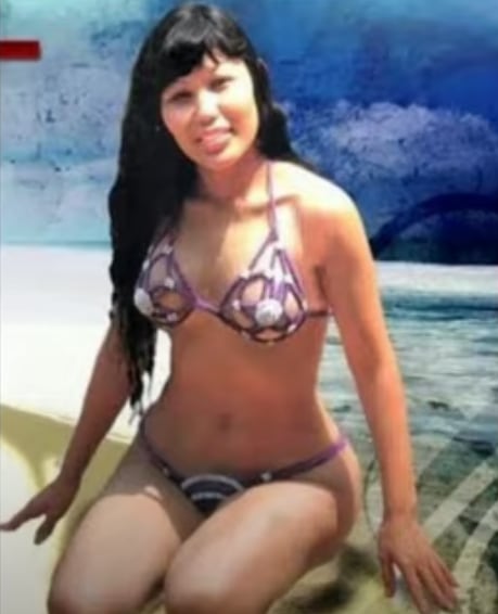 Lyn May antes de las operaciones