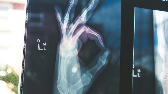 Este 8 de noviembre es el Día Mundial de la Radiología