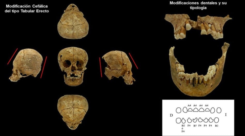 Restos de mujer en Tingambato