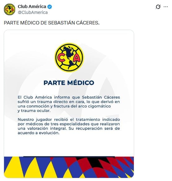 Sebastián Cáceres está en duda para la vuelta ante Pumas en los cuartos de final de la Liga MX.