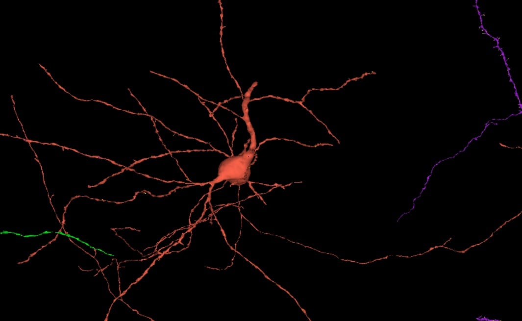 Neuronas con dos axones