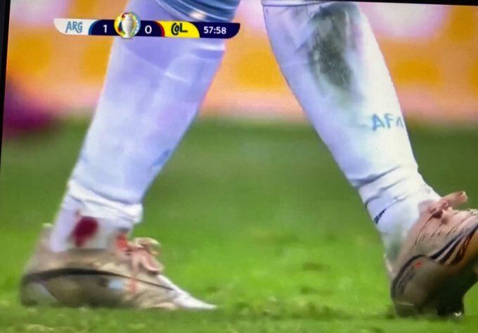 Lesión de Lionel Messi