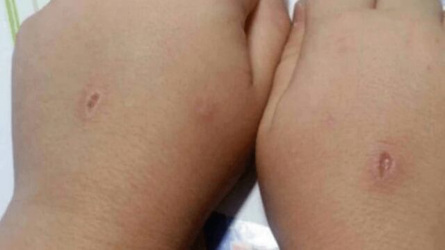 Las manos de una víctima.