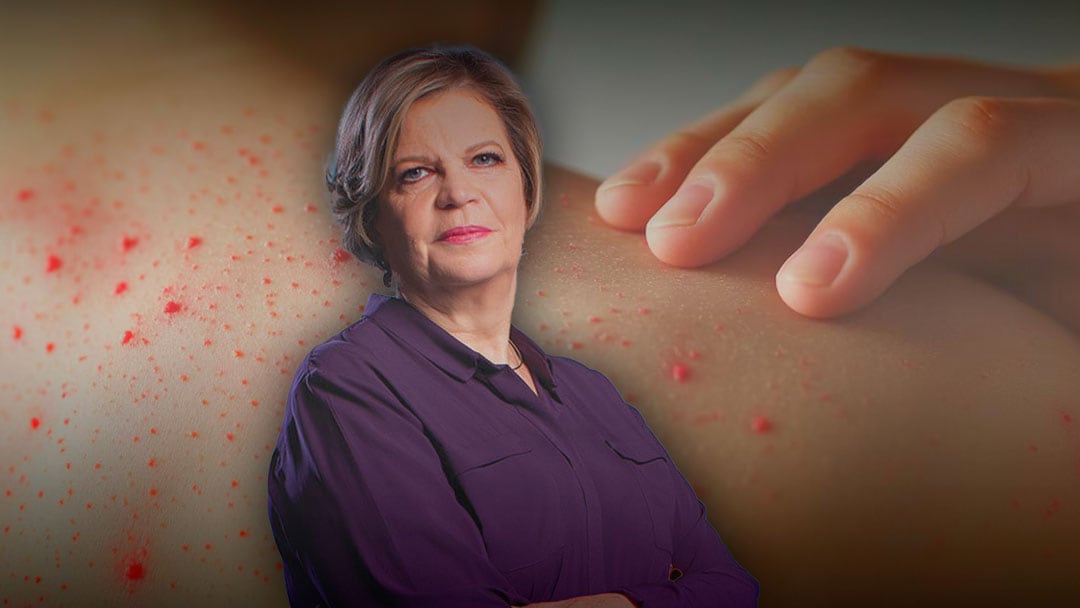 Era un bebé de 14 meses: confirman primera muerte por sarampión en la CDMX