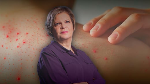 La Secretaría de Salud revela edad de la víctima por sarampión en CDMX