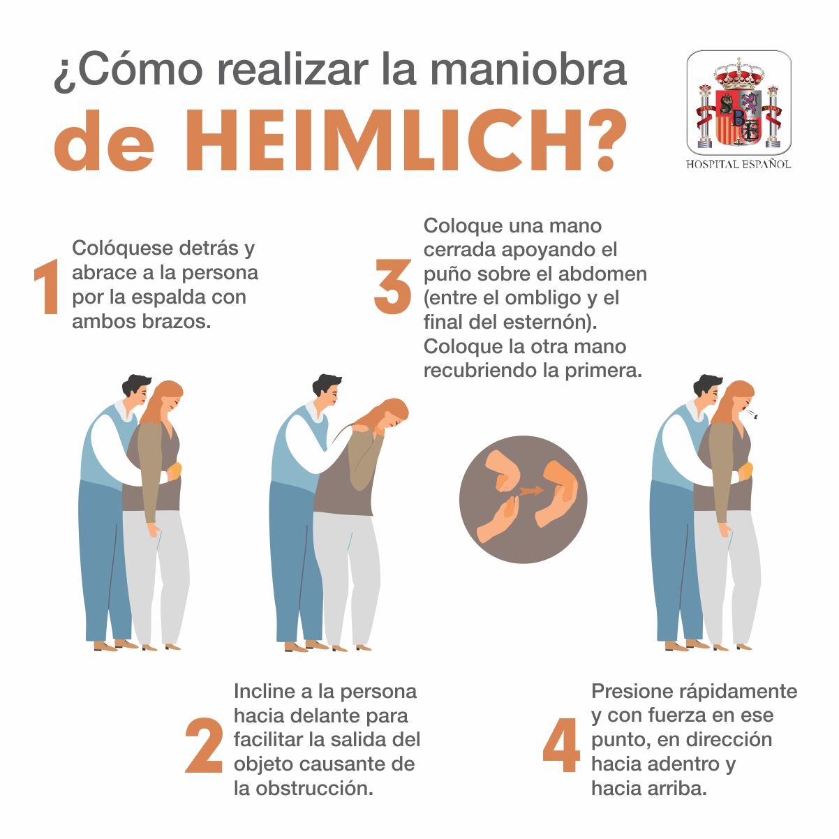 Maniobra de Heimlich
