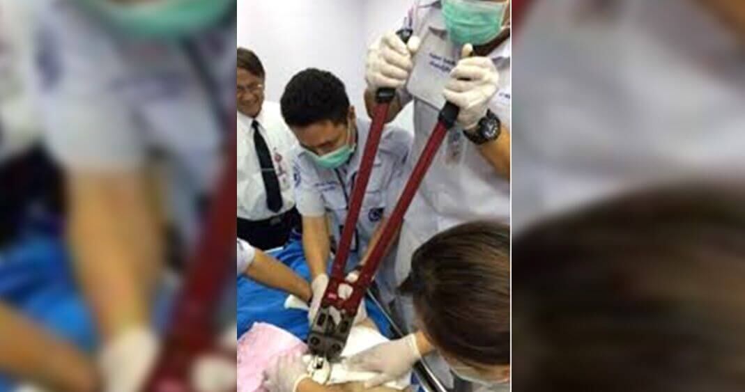 El afectado fue intervenido quirúrgicamente.