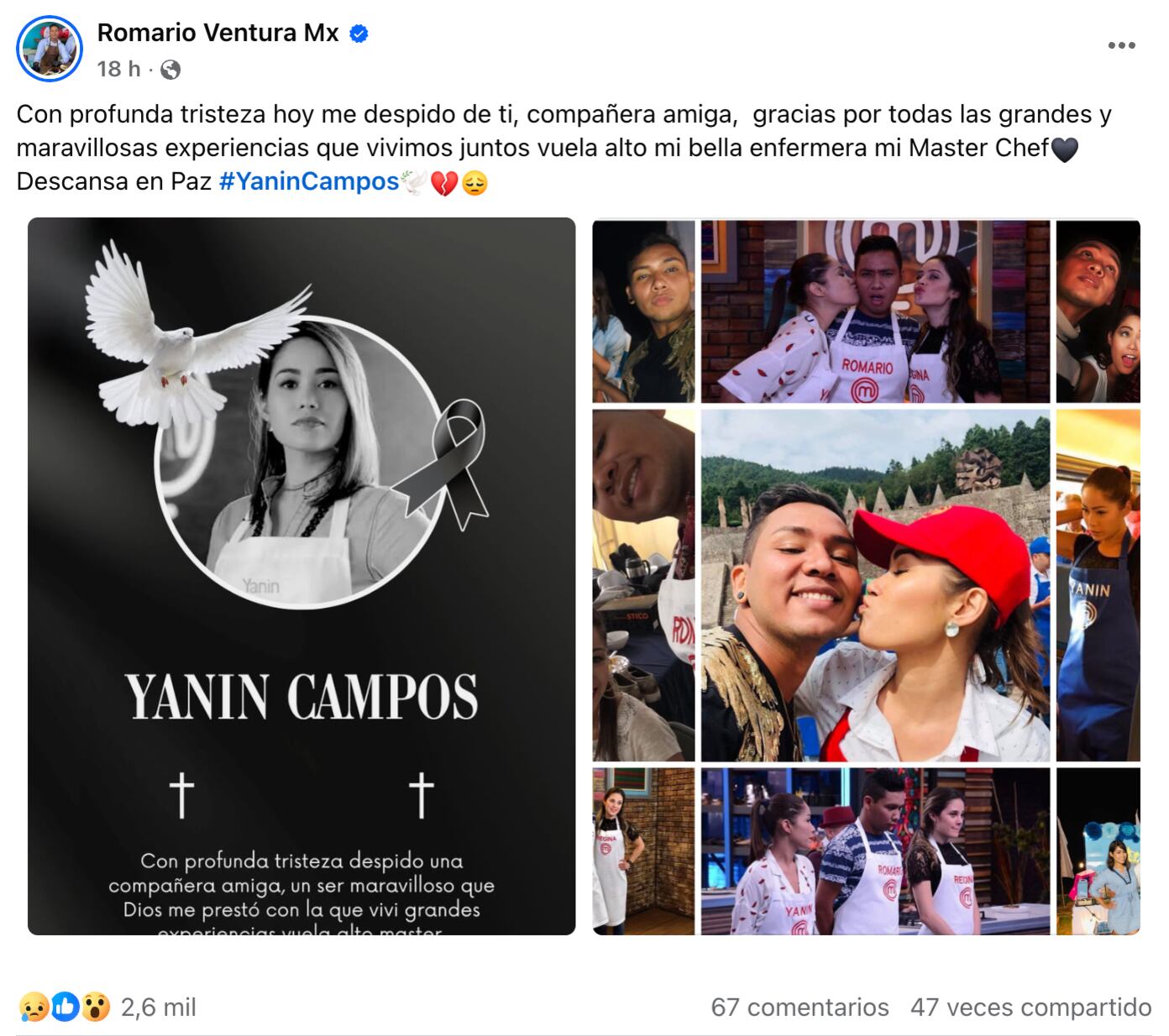 Foto del accidente de Yanin Campos, participante de MasterChef México