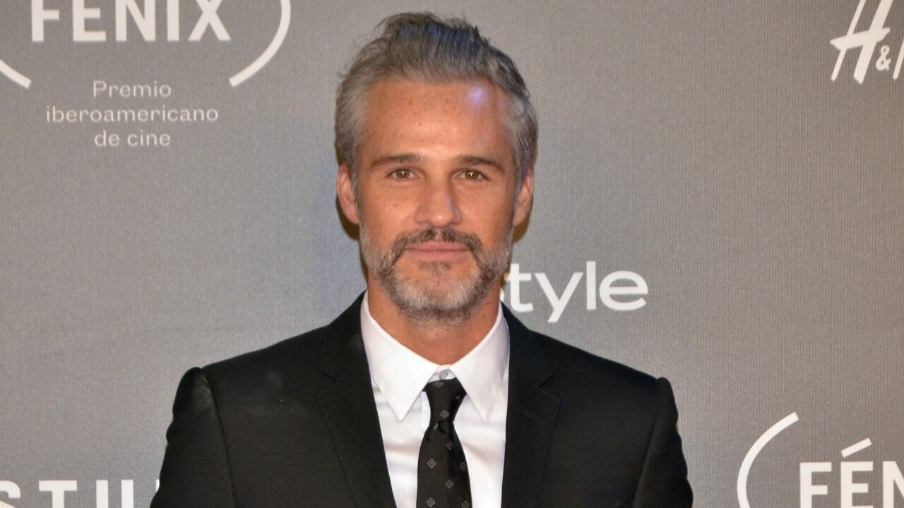 ¿Por qué le dio una trombosis a Juan Pablo Medina? Doctor explica a detalle