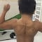 Niño con 'síndrome de Superman' impacta con musculoso cuerpo