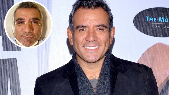 Héctor Sandarti aparece con moretones en el rostro y ya sabemos porqué.