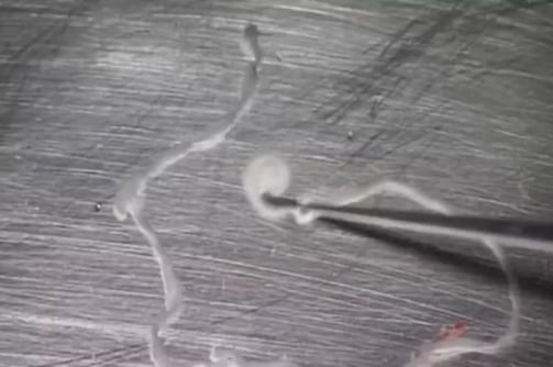 Este es el Sparganum mansoni, el parásito que se alimentó del cerebro de un hombre.