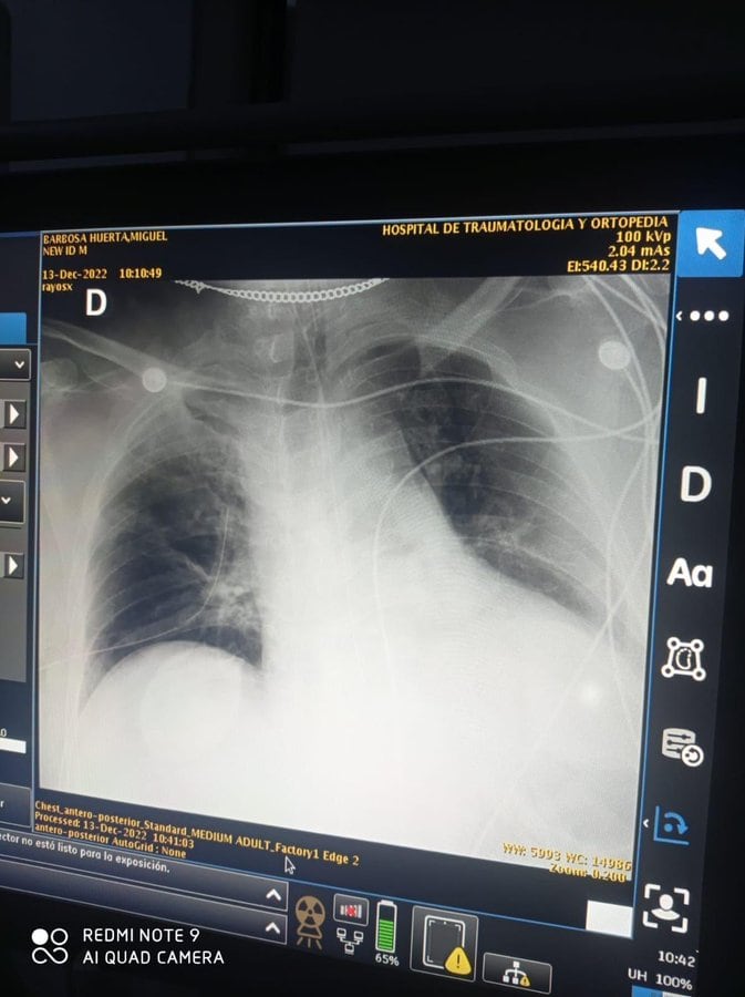 Radiografía Miguel Barbosa Huerta