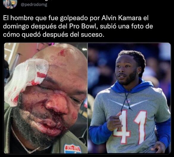 Hombre mostró agresiones de Alvin Kamara