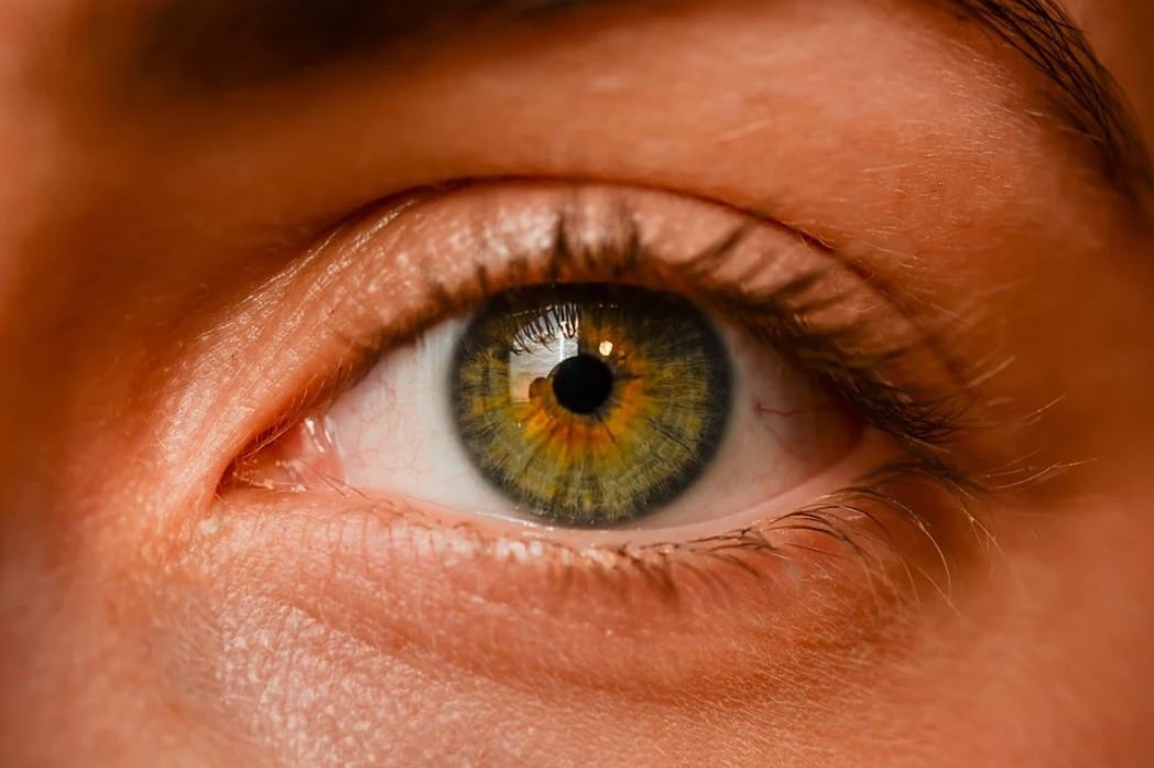 Ojo