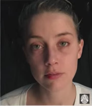 Amber Heard con heridas