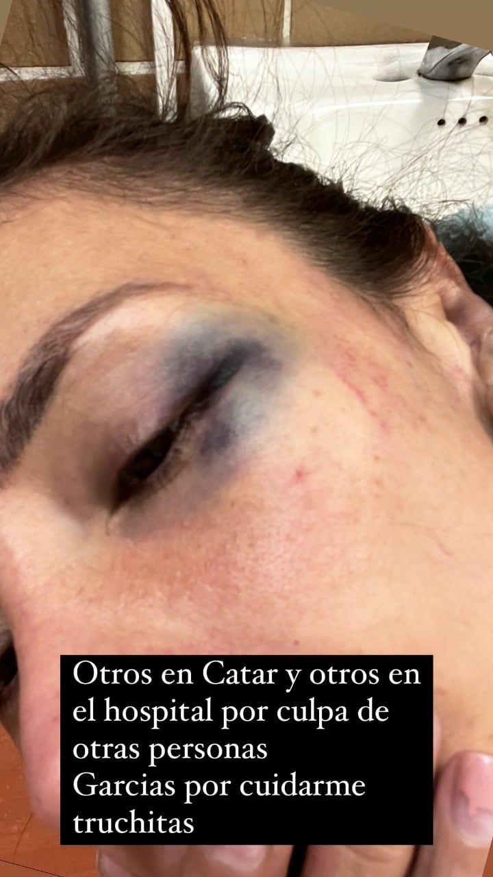 Pao Poulain denuncia golpes y retención en hospital contra su voluntad.