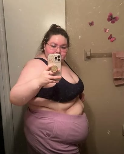 Allison Fisher, la mujer que pensó tenía obesidad pero estaba cargando un quiste de 50 kilos