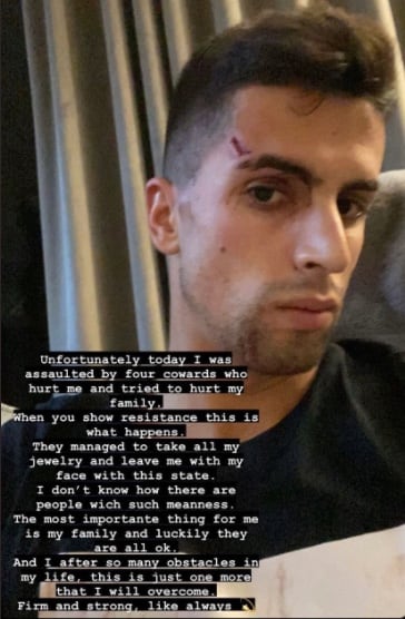 Joao Cancelo y su familia fueron víctimas de un asalto a su casa en Manchester