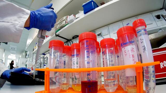 Caso sospechoso de coronavirus en Oaxaca.