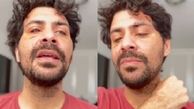 ComeGuillermo Collard, actor, denuncia que fue asaltado en CDMXntarios video de Guillermo Collard