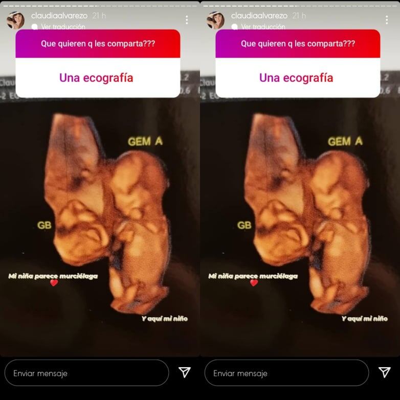 Claudia Álvarez muestra ecografía de sus gemelos.
