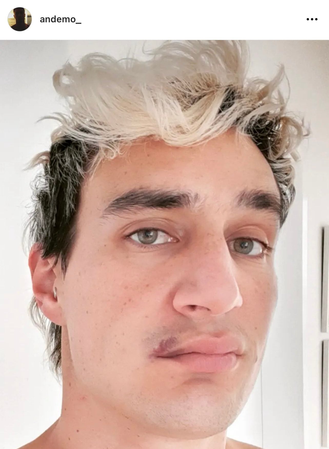 Víctima de la agresión